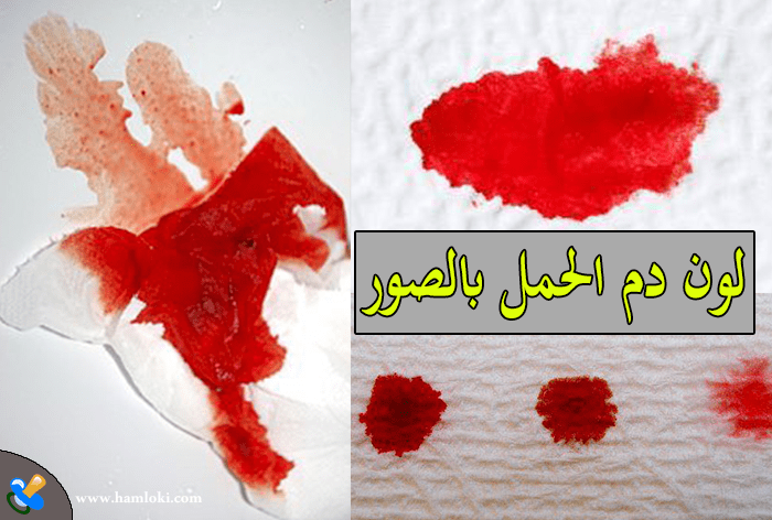 لون دم الحمل بالصور الاختلاف بين دم الدورة الشهرية و دم الحمل Hamloki Com