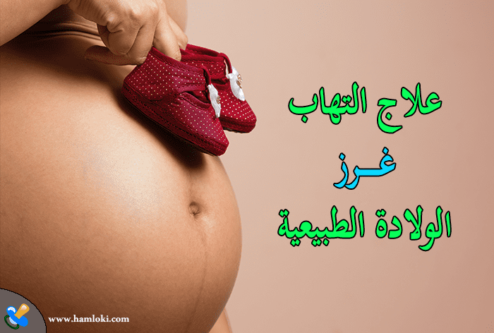 التهاب غرز الولادة الطبيعية : تعرف على علاجها والتخلص منها